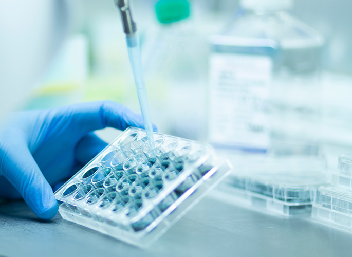 Bioanalytical Method Development 
and Validation
