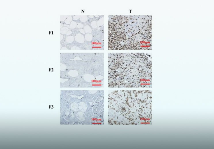 Establishment of disease models