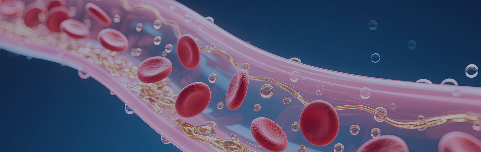 Cardiovascular & Cerebrovascular Disease Models